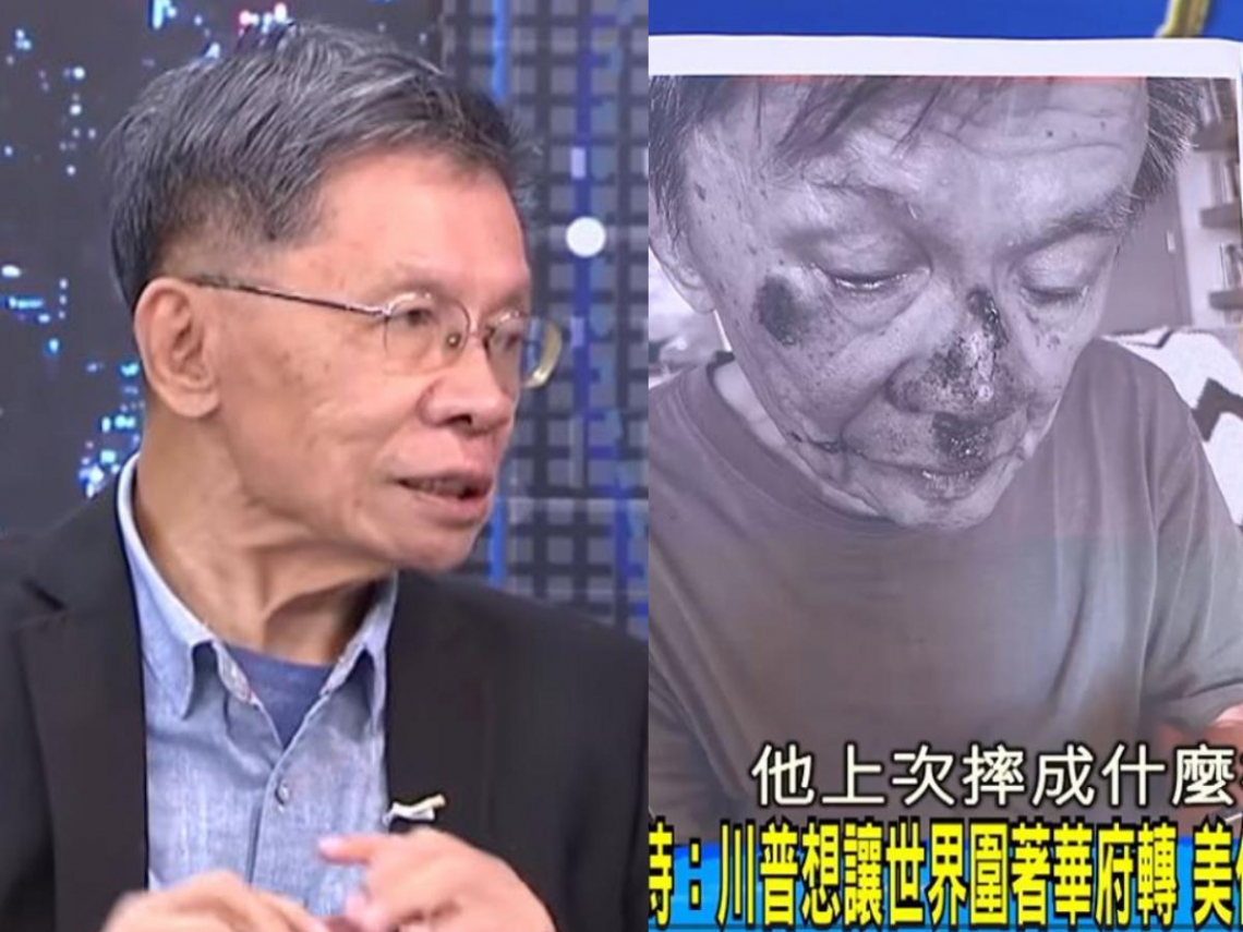 87歲沈富雄重摔滿臉血，傷勢驚悚照曝光！還原跌倒當下嘆「我真的老了」...年長者日常防跌5關鍵必知
